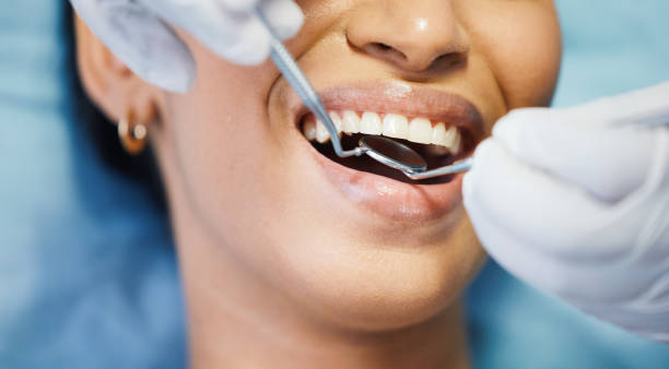 Best Emergency Root Canal Treatment in Madison, WV